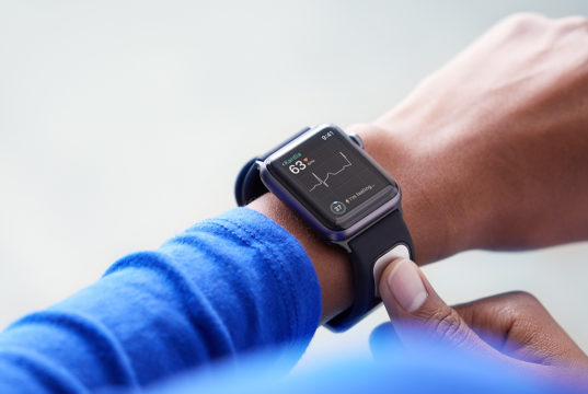 El Apple Watch te alerta ante un posible ataque cardíaco